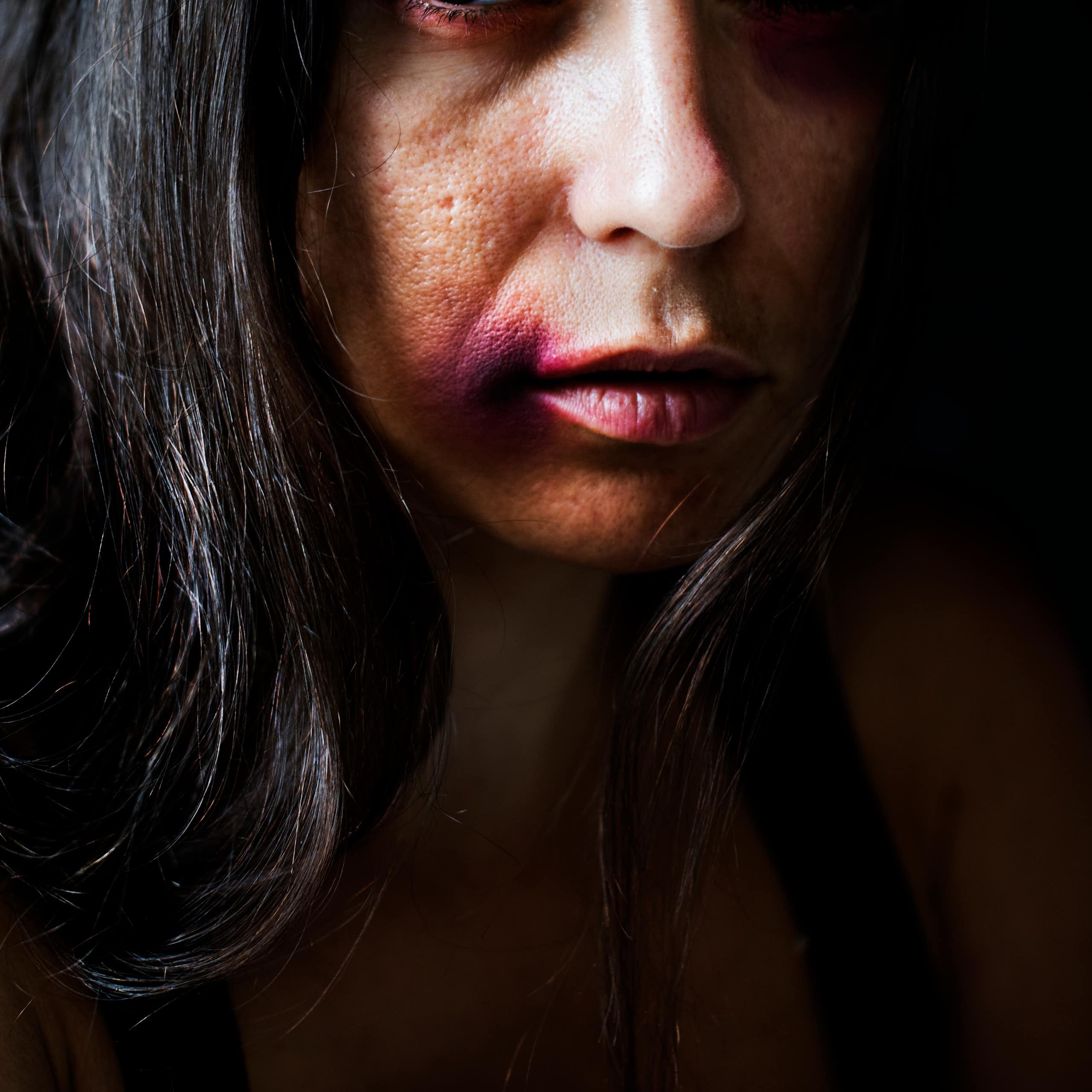 Imobilidade tônica: o que é a resposta instintiva ao estupro que pode causar ainda mais desamparo às vítimas