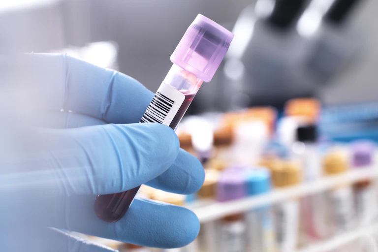 Hand in blue medical glove holds test tube with blood.