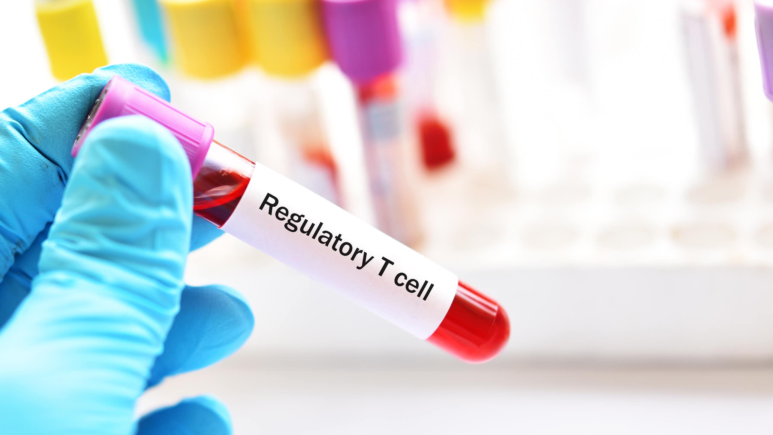A blue-gloved hand holding a test vial of blood with a sticker that reads 'Regulatory T cell'