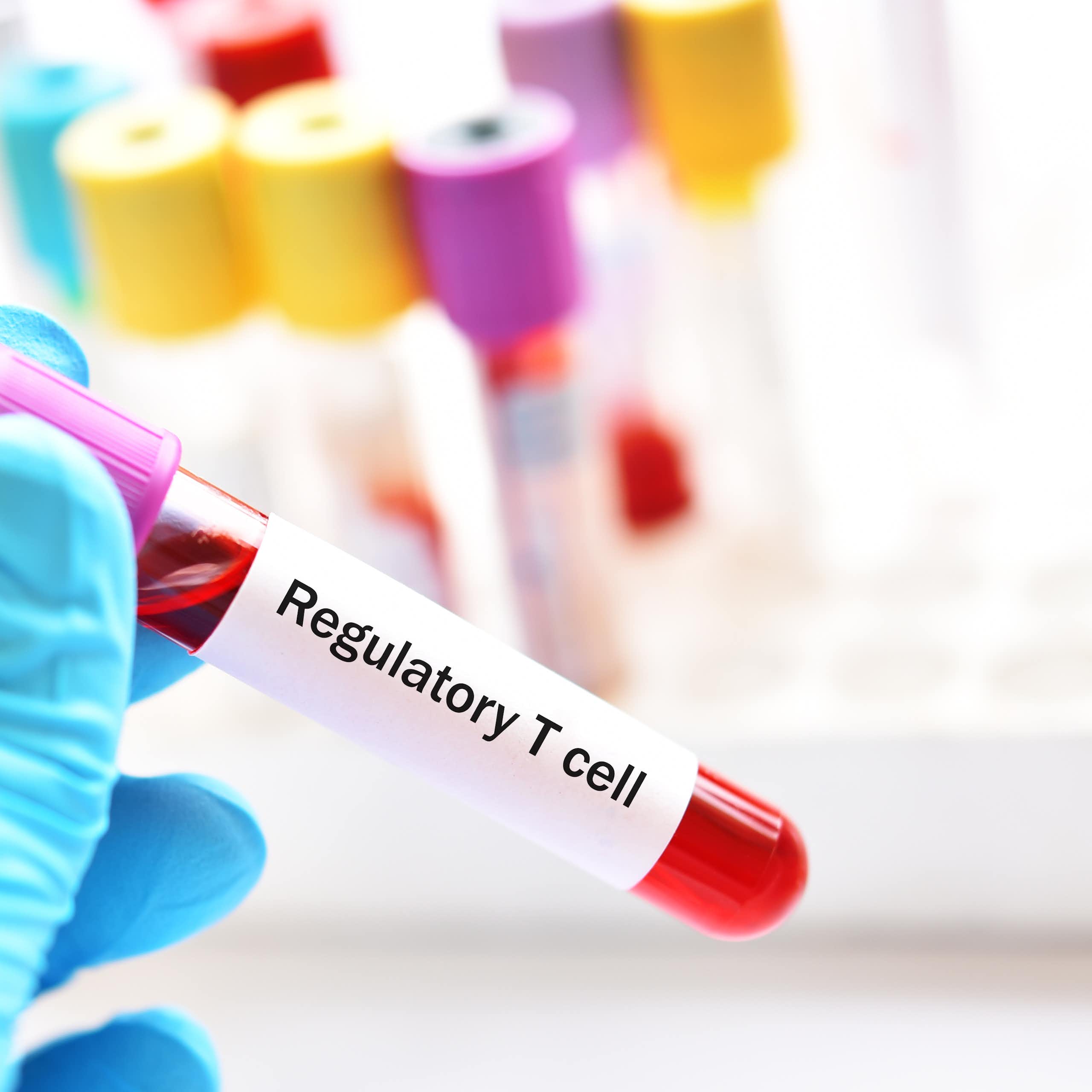 A blue-gloved hand holding a test vial of blood with a sticker that reads 'Regulatory T cell'