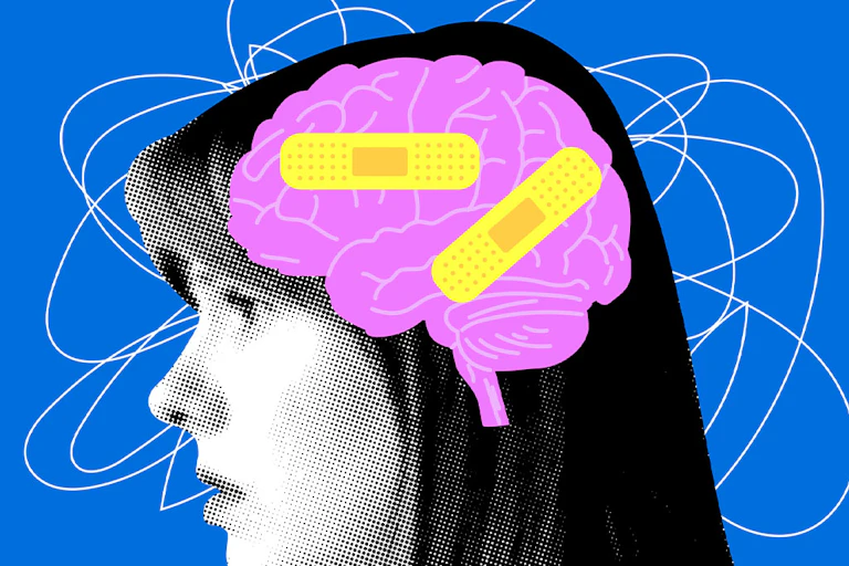 Ilustración que muestra a una mujer con el cerebro pintado de rosa con dos tiritas