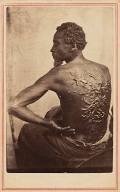 the image shows a Black man sitting and facing away from the camera, his back deeply scarred by whipping