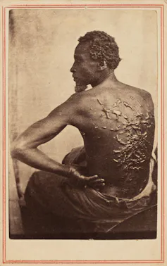 the image shows a Black man sitting and facing away from the camera, his back deeply scarred by whipping