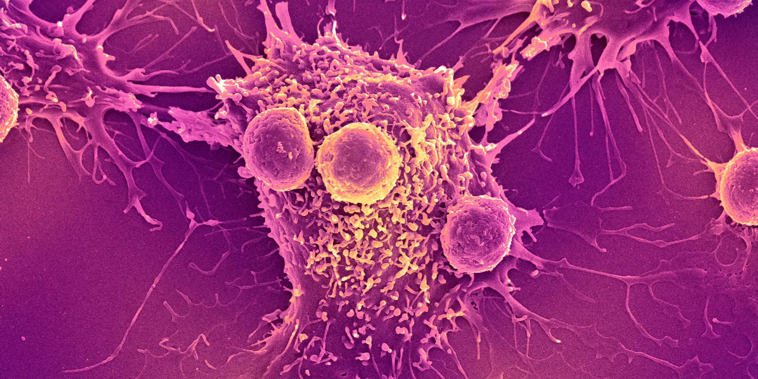 COVID-19 mRNA vaccines could unlock the next revolution in cancer treatment – new research