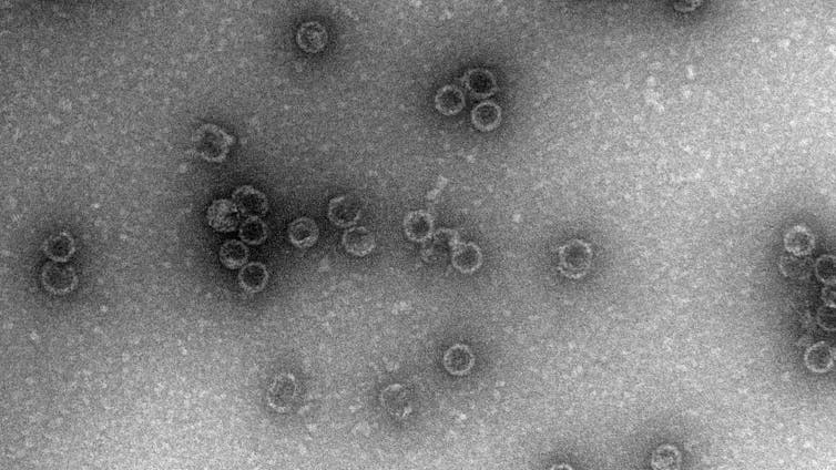 Black and white image showing small circular blobs against a scale bar marked '200 nm'.