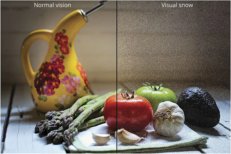 A collection of fruit and vegetables, half of which are covered in static.