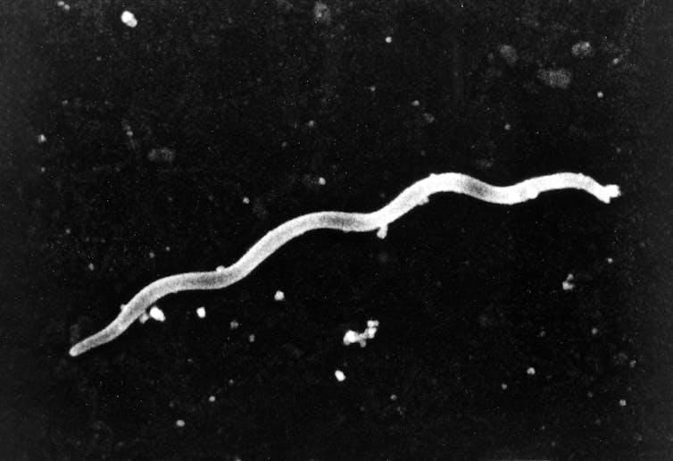 Lyme illness: how the bacterium "Borrelia burgdorferi" infects us 1 file 20251031 56 qputn7.jpg?ixlib=rb 4.1