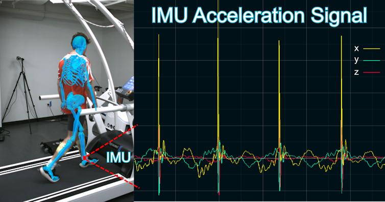A la izquierda, una ilustración de un esqueleto se superpone a una fotografía de una persona en una cinta de correr; a la derecha, una serie de líneas irregulares horizontales