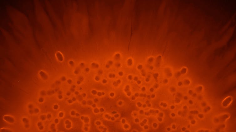 Bacteria labeled M. Cherry