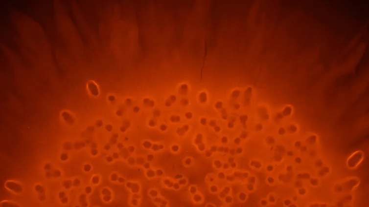 mCherry labelled bacteria