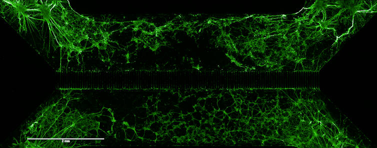 Stem cellular treatment: a brand new technology in mind regeneration after stroke? 2 file 20251104 56 9j249j.png?ixlib=rb 4.1