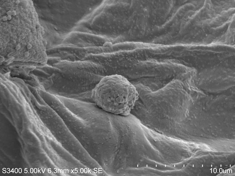 When the sector’s greatest battery energy plant stuck hearth, poisonous metals rained down – wetlands captured the fallout 4 A zoomed in look at a small lump on a leaf