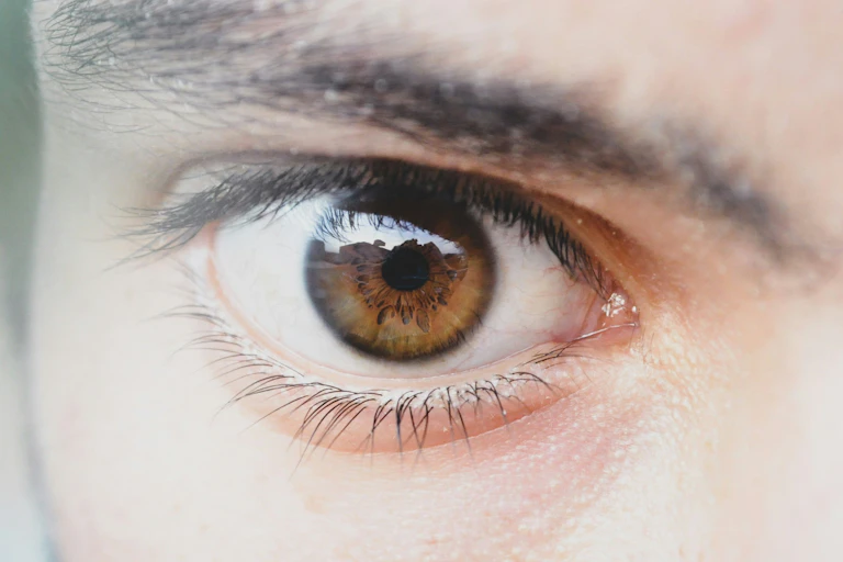 A brown eyeball