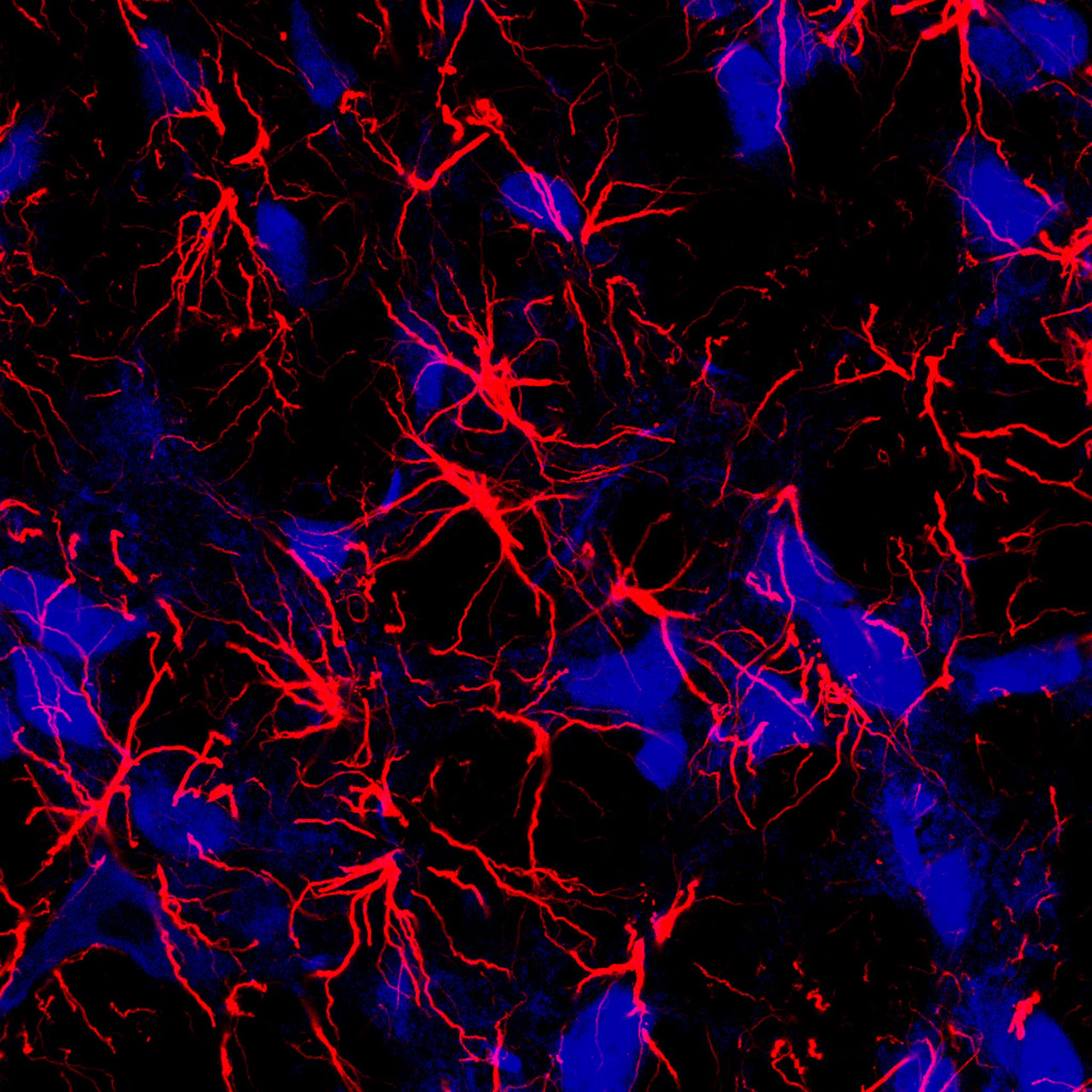 Microscopy image of clusters of red neurons with long extensions
