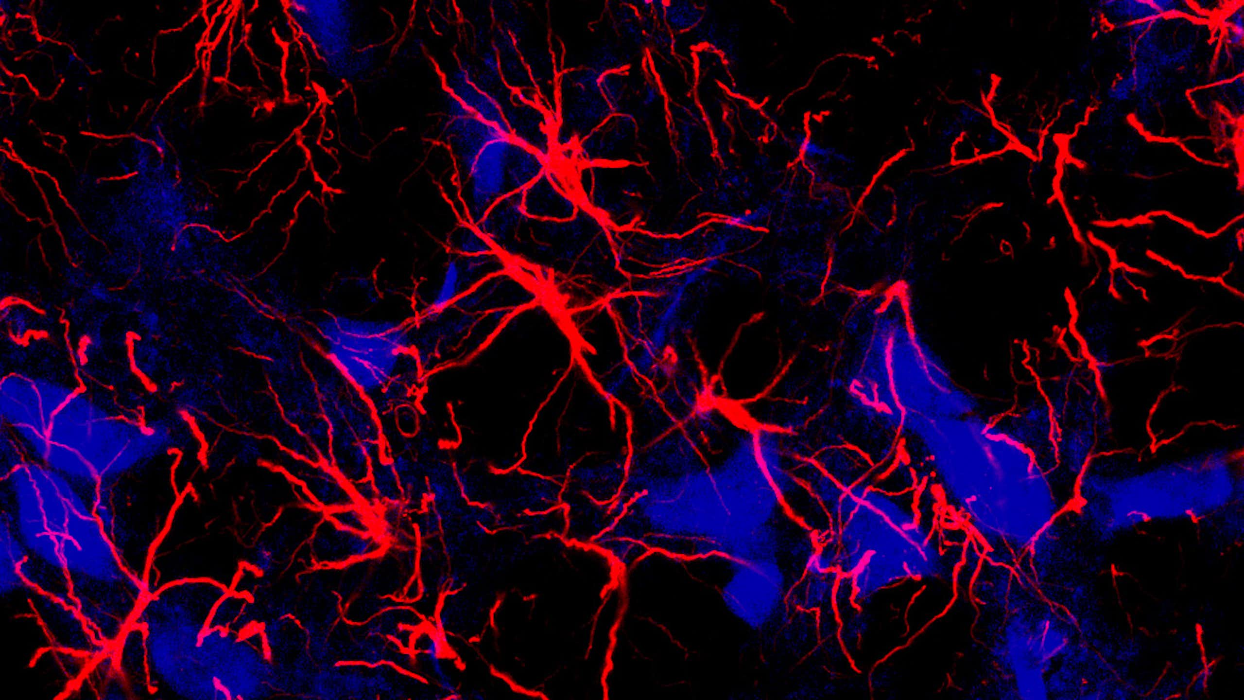 Microscopy image of clusters of red neurons with long extensions