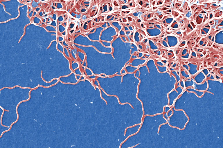 Cette image obtenue par microscopie électronique à balayage (fausses couleurs) montre des bactéries anaérobies à Gram négatif Borrelia burgdorferi, responsables de la maladie de Lyme.