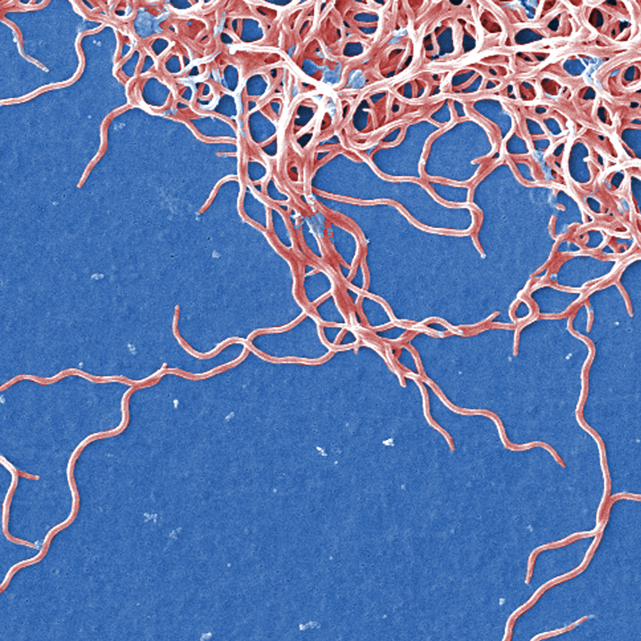Cette image obtenue par microscopie électronique à balayage (fausses couleurs) montre des bactéries anaérobies à Gram négatif Borrelia burgdorferi, responsables de la maladie de Lyme.