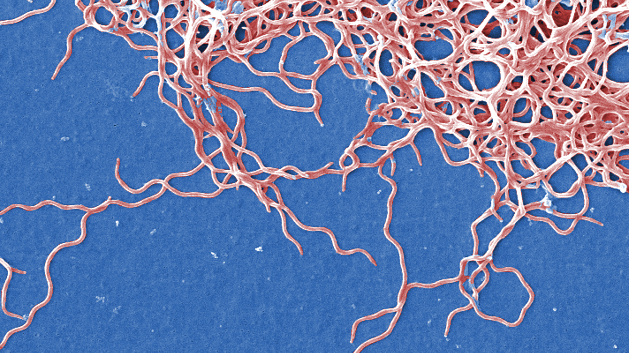 Cette image obtenue par microscopie électronique à balayage (fausses couleurs) montre des bactéries anaérobies à Gram négatif Borrelia burgdorferi, responsables de la maladie de Lyme.