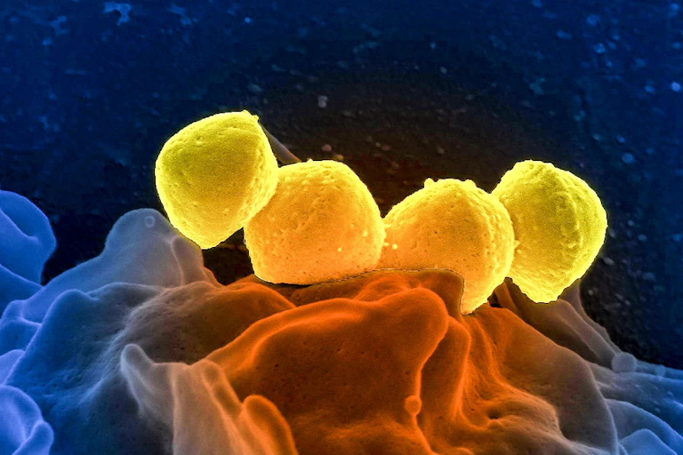 Quatre bactéries Streptococcus pyogenes, de couleurs jaune, du groupe A (GAS), qui se trouvaient sur la surface d'un globule blanc humain (globule blanc), connu sous le nom de polynucléaires neutrophiles.