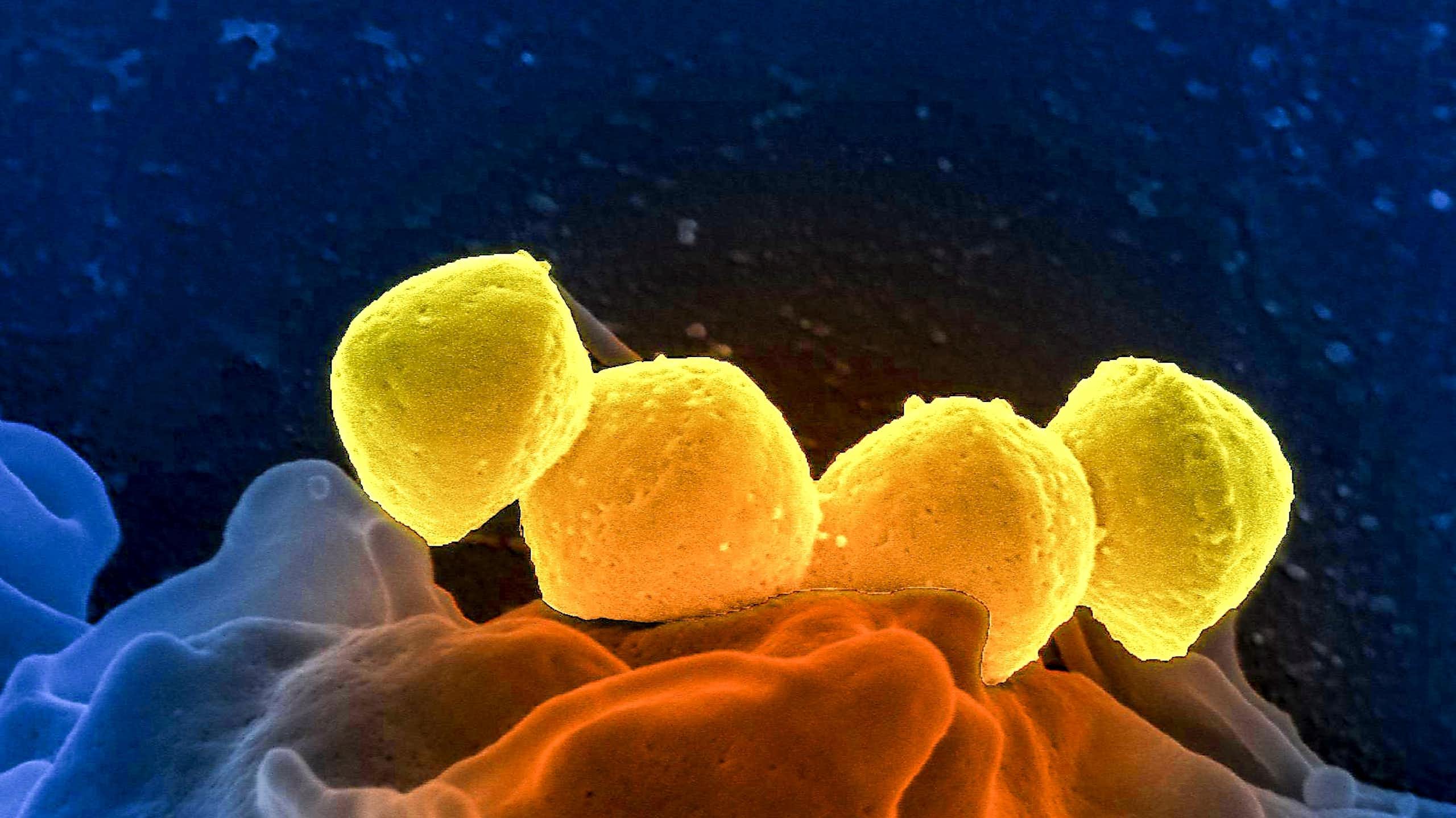 Quatre bactéries Streptococcus pyogenes, de couleurs jaune, du groupe A (GAS), qui se trouvaient sur la surface d'un globule blanc humain (globule blanc), connu sous le nom de polynucléaires neutrophiles.