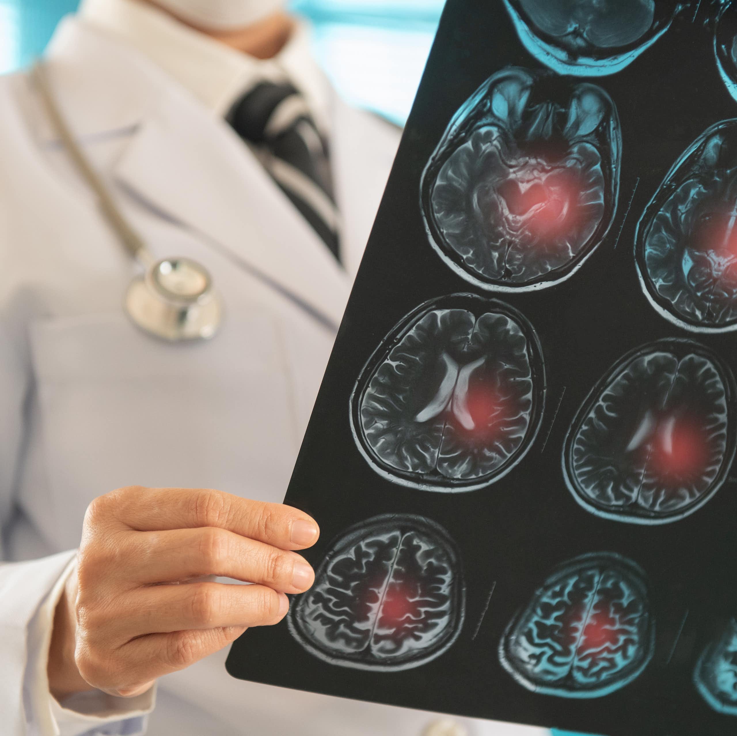 Un médico examina imágenes del cerebro de un paciente.