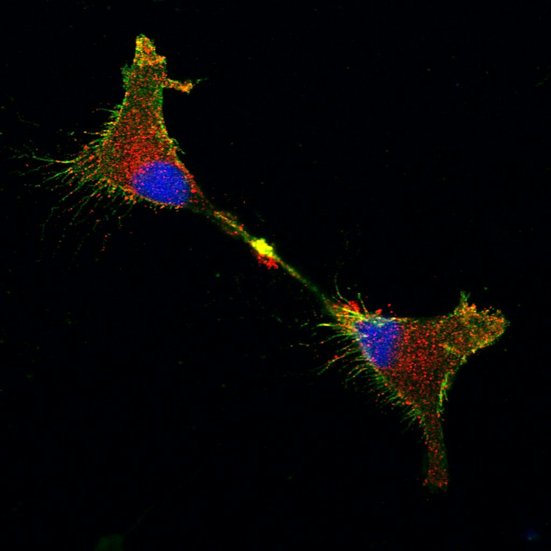 Biologia celular: A surpreendente jornada da proteína prion no cérebro