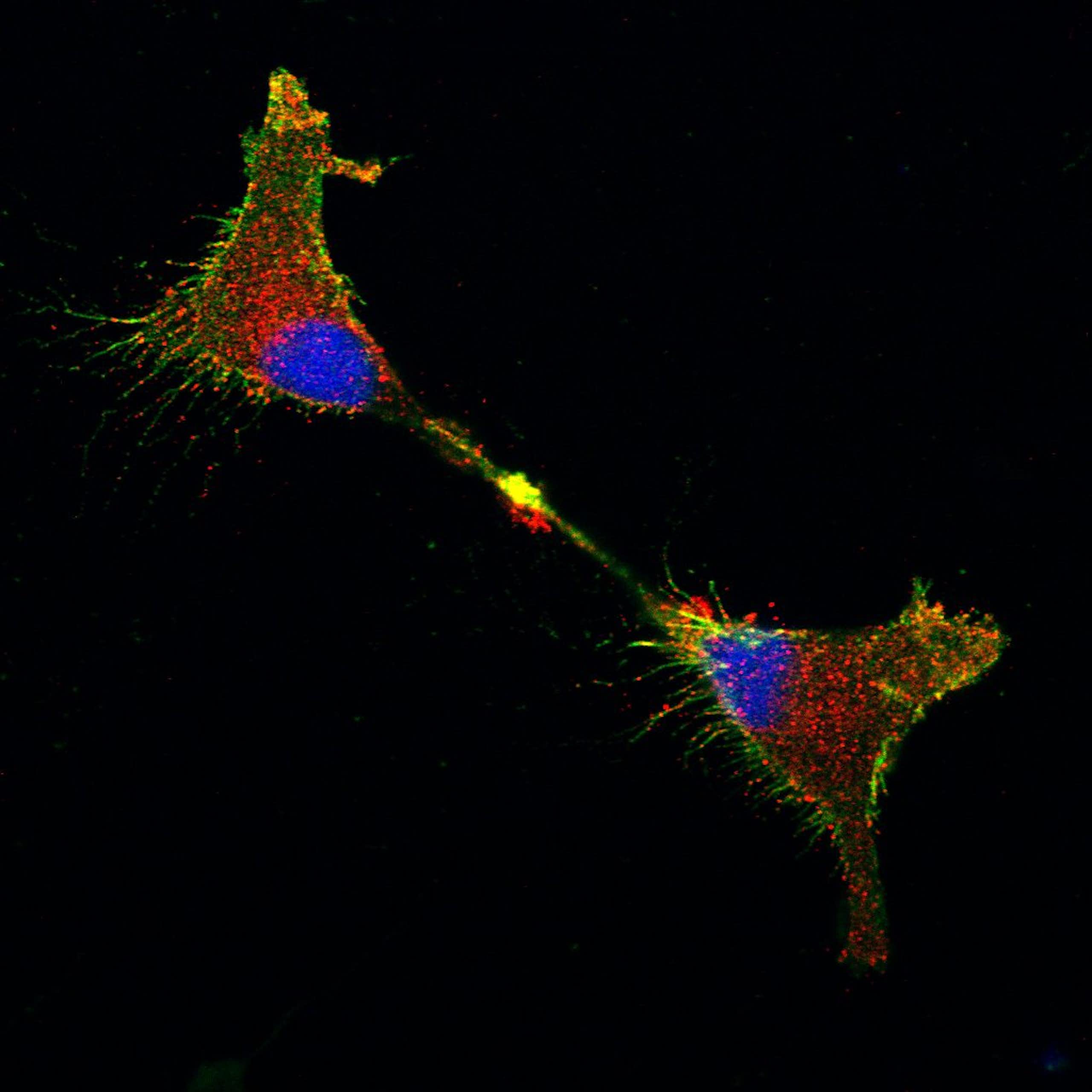 Biologia celular: A surpreendente jornada da proteína prion no cérebro