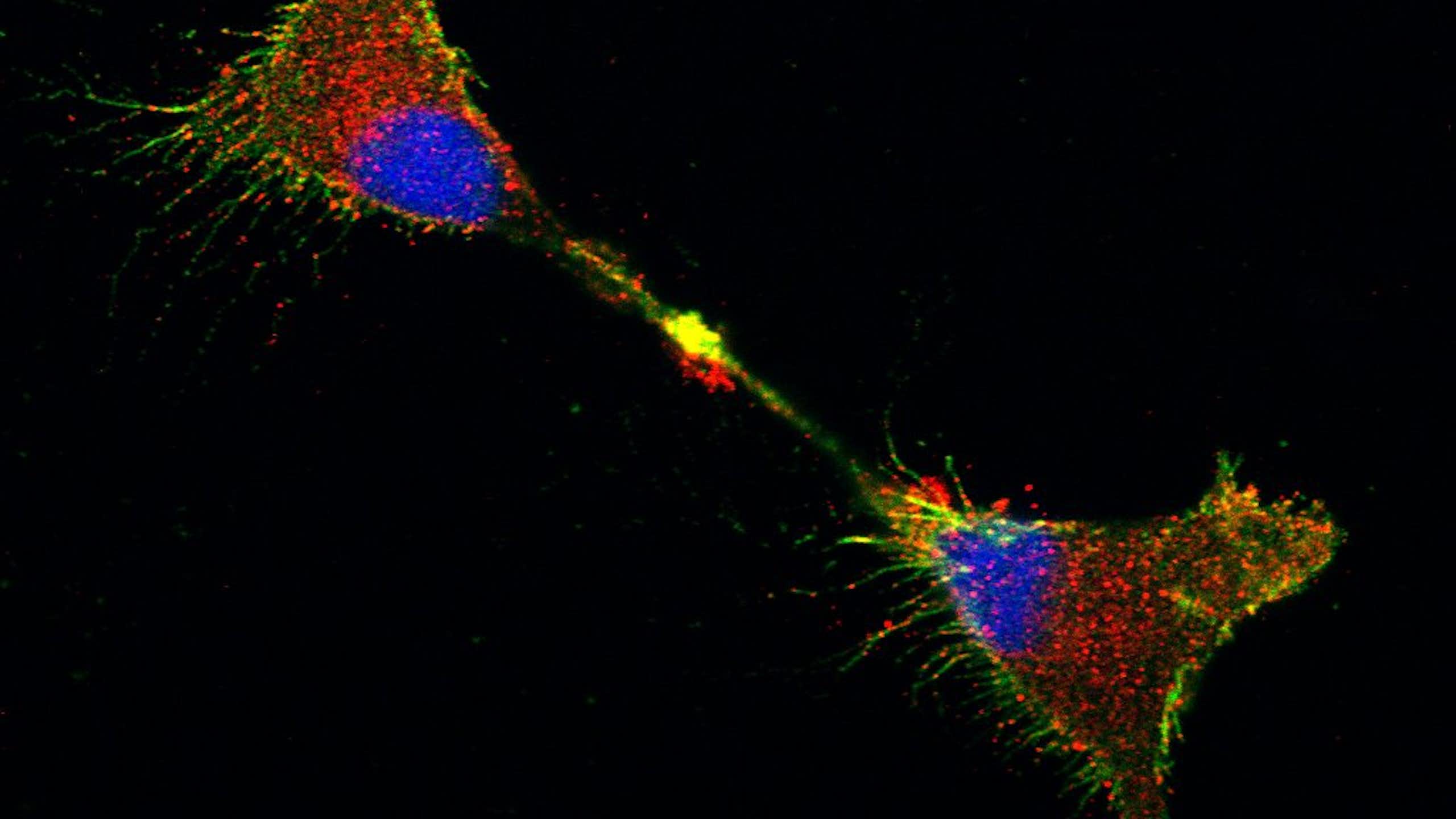 Biologia celular: A surpreendente jornada da proteína prion no cérebro