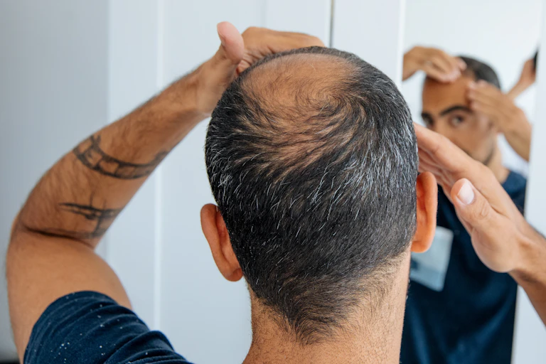 Man inspects bald spot in the mirror.