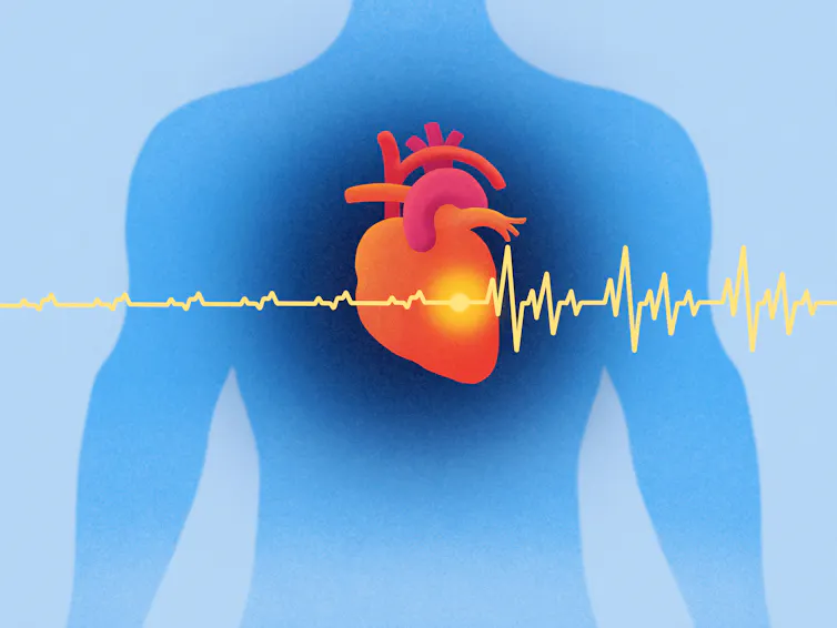 Illustration of a human chest with heart and pacemaker