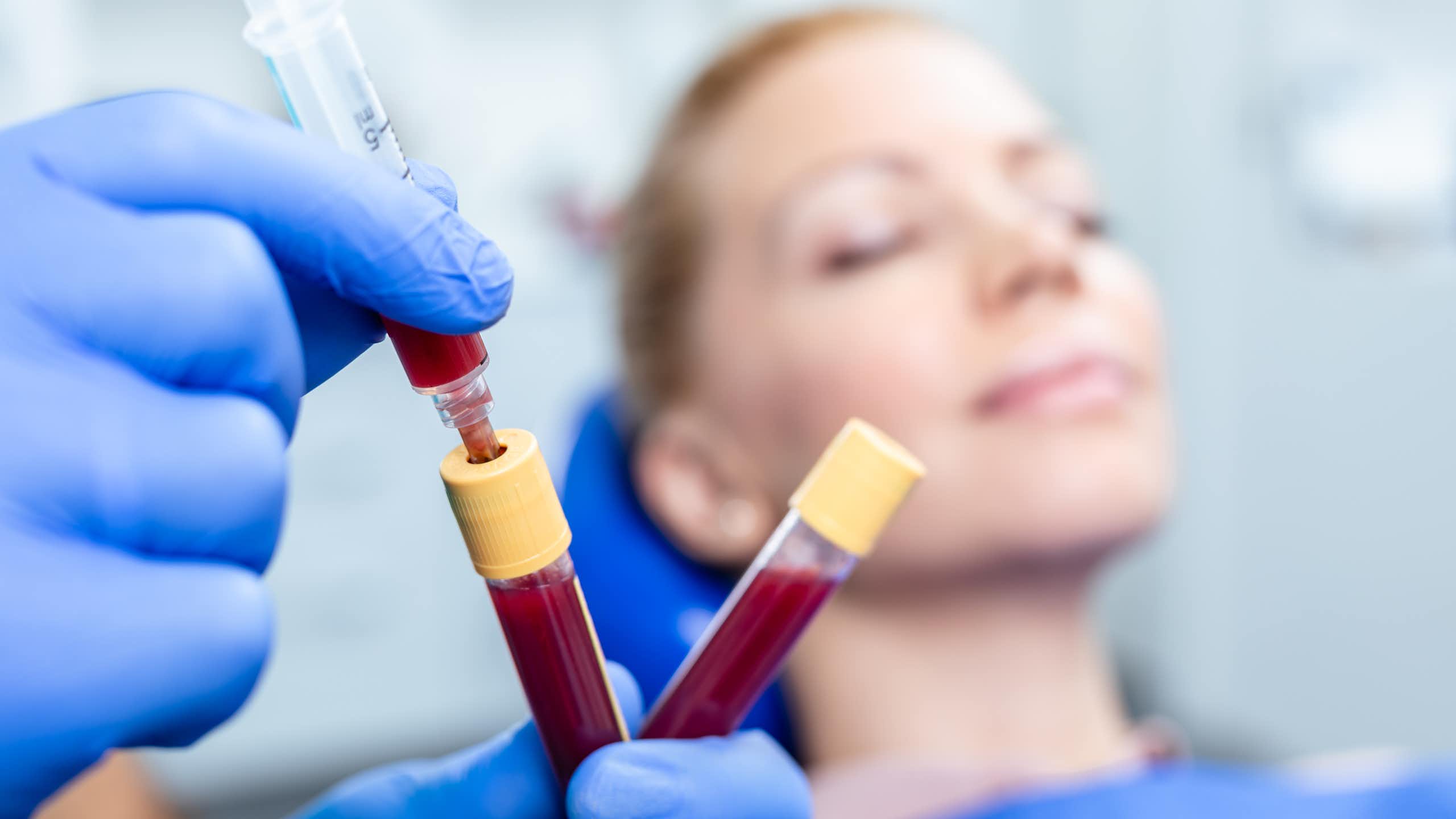 “Máscara menstrual”: o que a ciência diz sobre a mais nova moda em beleza facial nas redes sociais