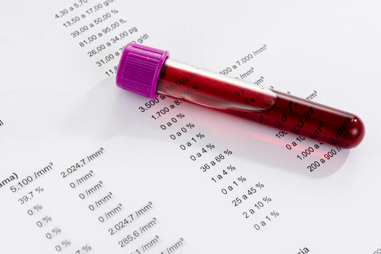 Blood sample on top of print out of complete blood count results