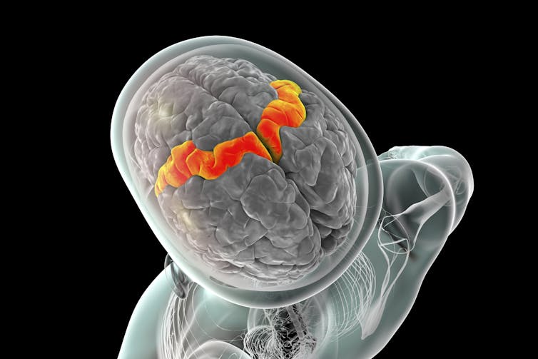 Why can’t I wiggle my feet one by one, like my arms? 4 illustration of a brain looking down at the top of the head with one section highlighted orange