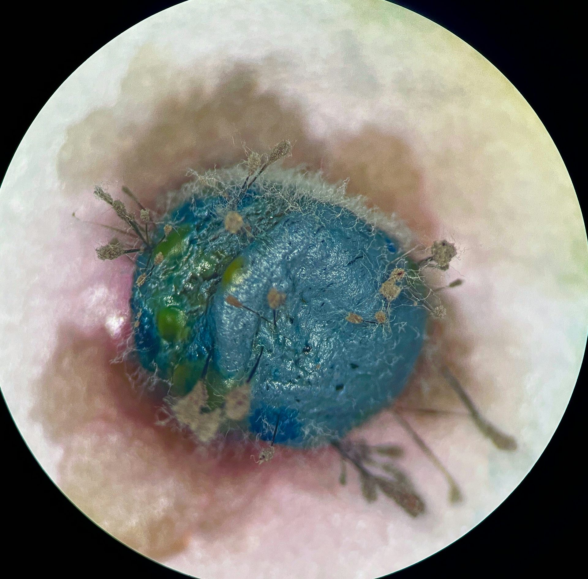 Plastic ‘bio-beads’ from sewage plants are polluting the oceans and spreading superbugs – but there are alternatives – The Conversation