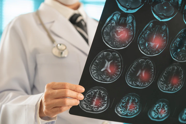 Um médico examina imagens do cérebro de um paciente.