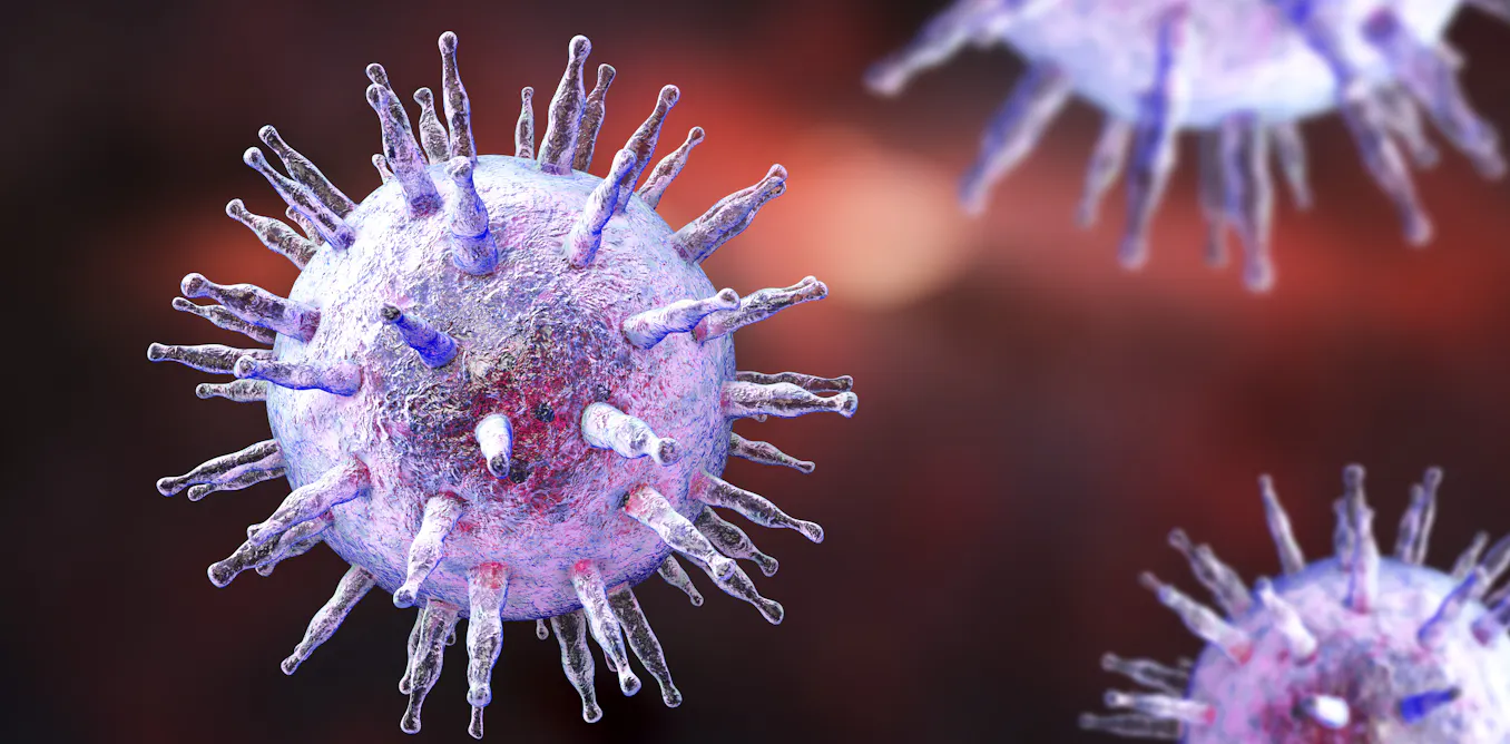 The virus nearly everyone has and its possible role in MS