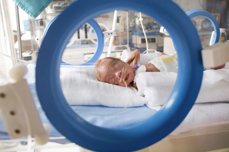 Preterm baby lying on an infant hospital bed.