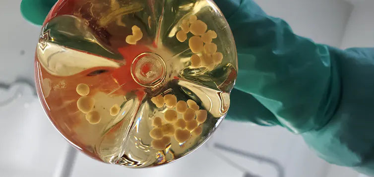 Brain organoids in a flask.