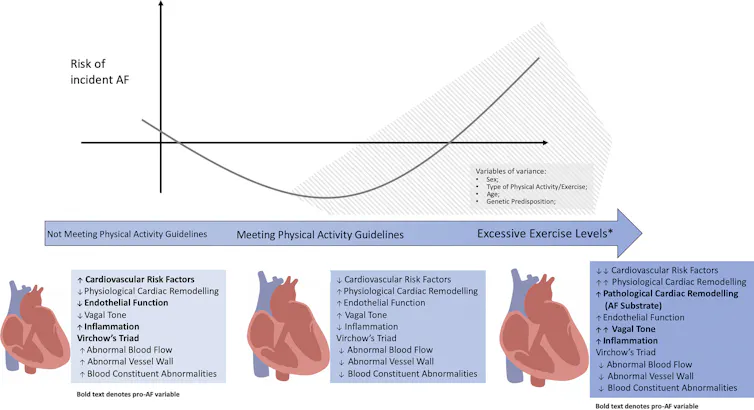 A chart showing the J-shaped relationship between exercise and atrial fibrillation risk.