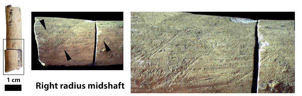 Marks incised on the shaft of the lower arm bone (radius) were inflicted by a stone tool. The bone then turned gray as it burned. The area in the box on the left is enlarged on the right of the image. Jessica Thompson