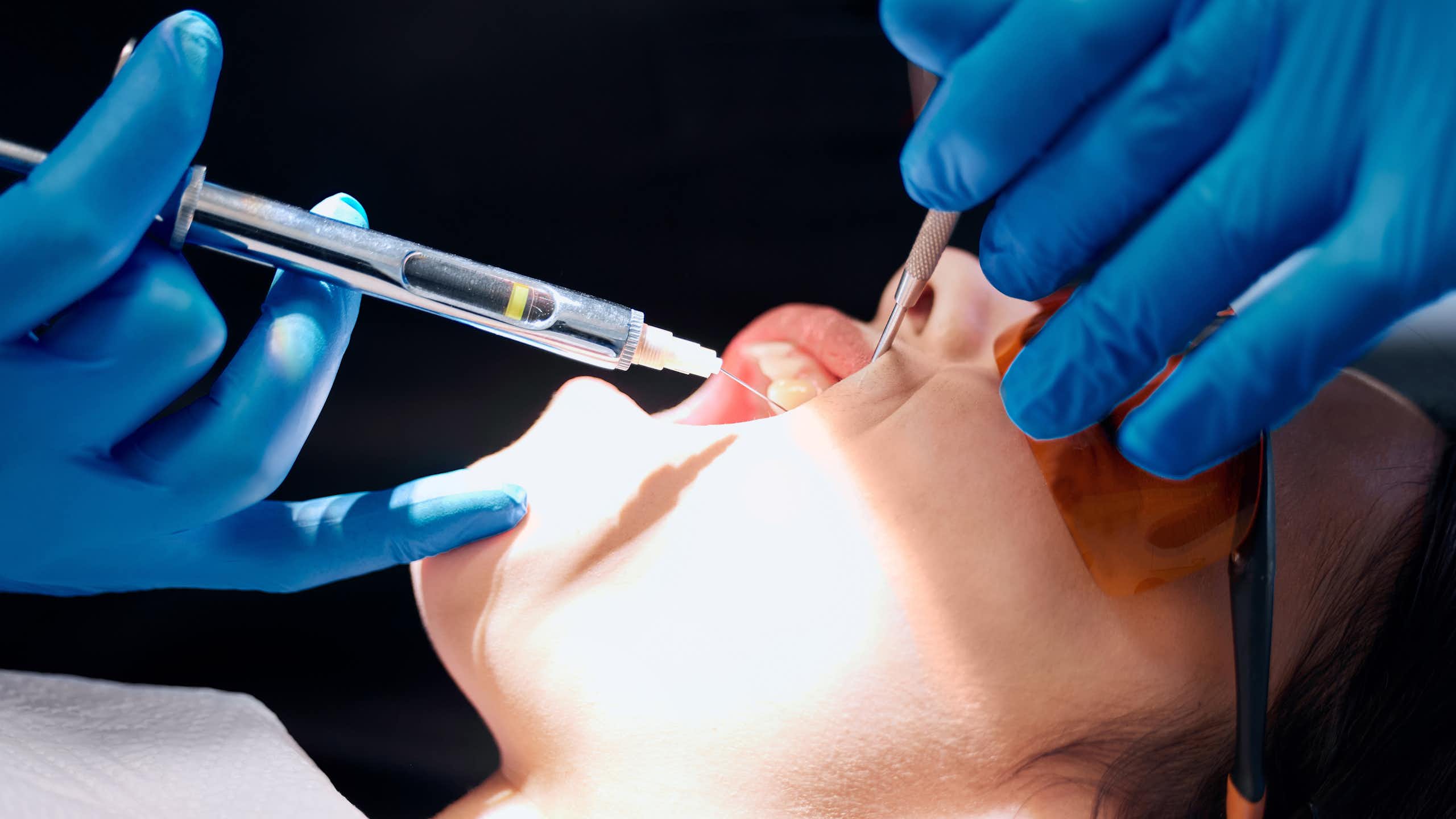 Asministración de anestesia con una jeringuilla a una mujer con la boca abierta.