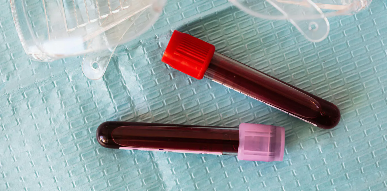 Treating previously untreatable cancers: How CAR-T cell therapy could be made accessible to more patients