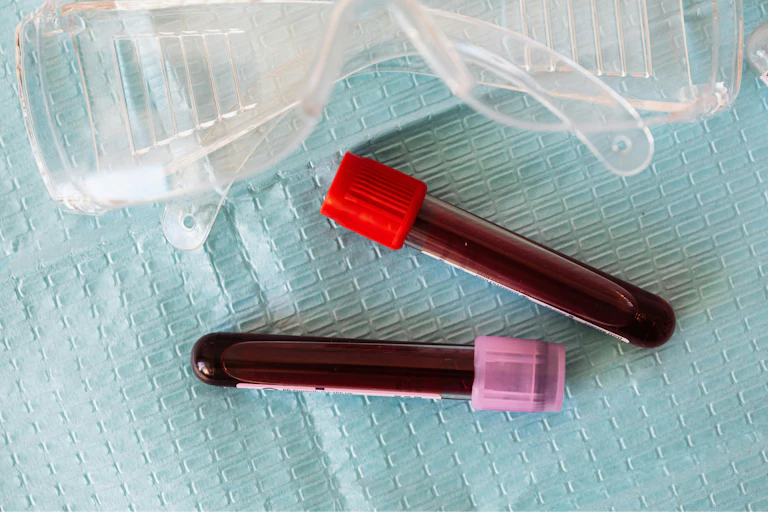 Blood vials and safety goggles on a blue background