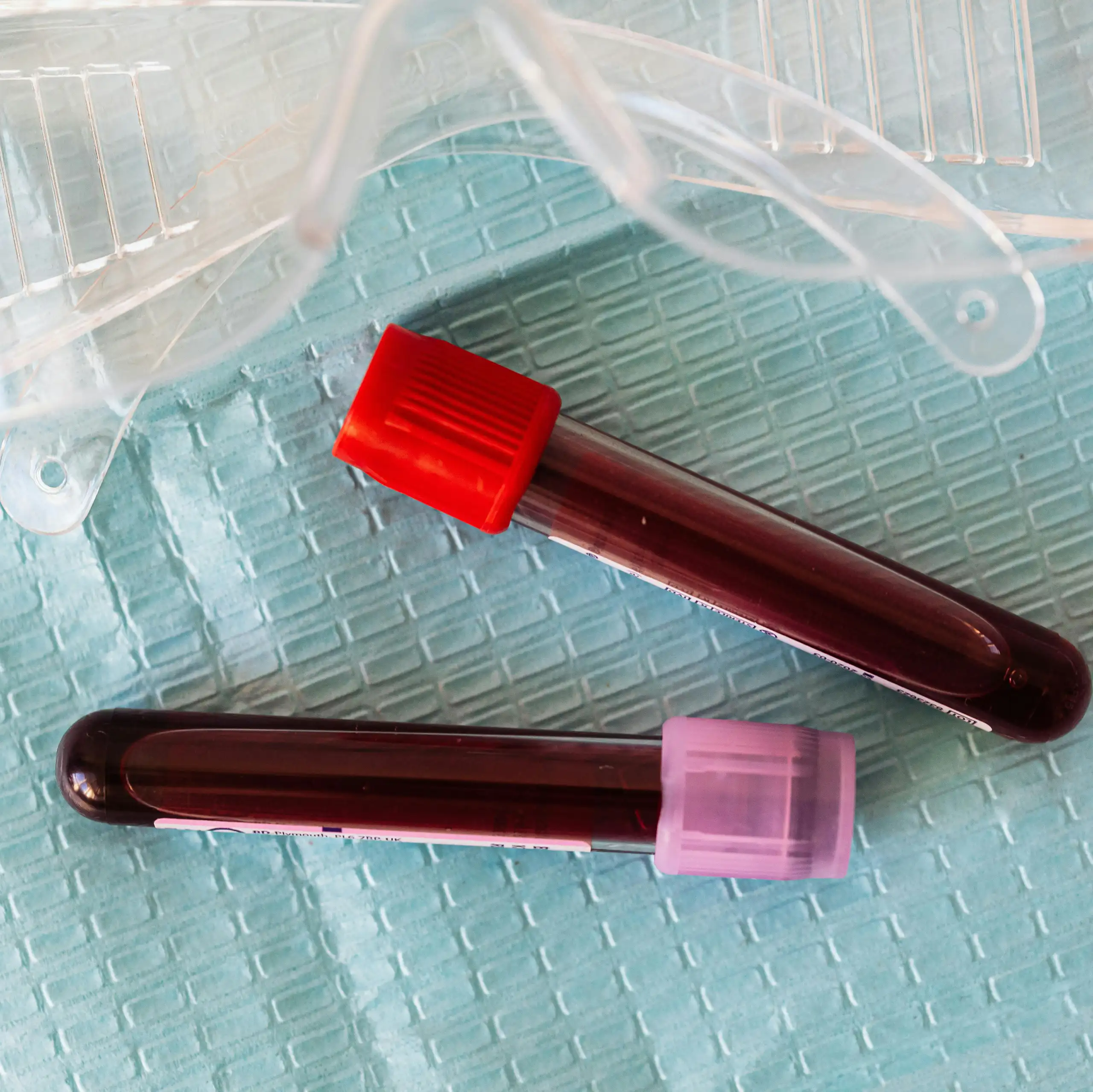 Blood vials and safety goggles on a blue background