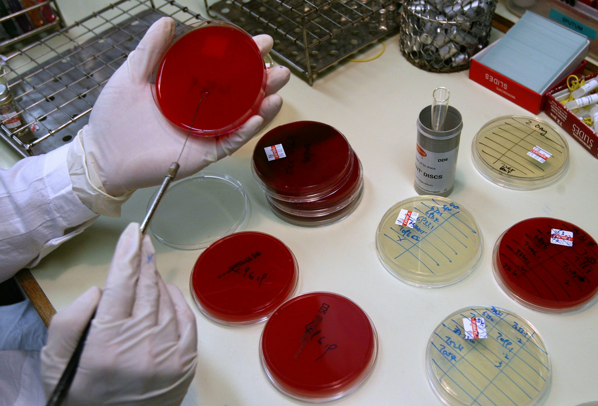 Gloved hands and round glass dishes in a laboratory environment
