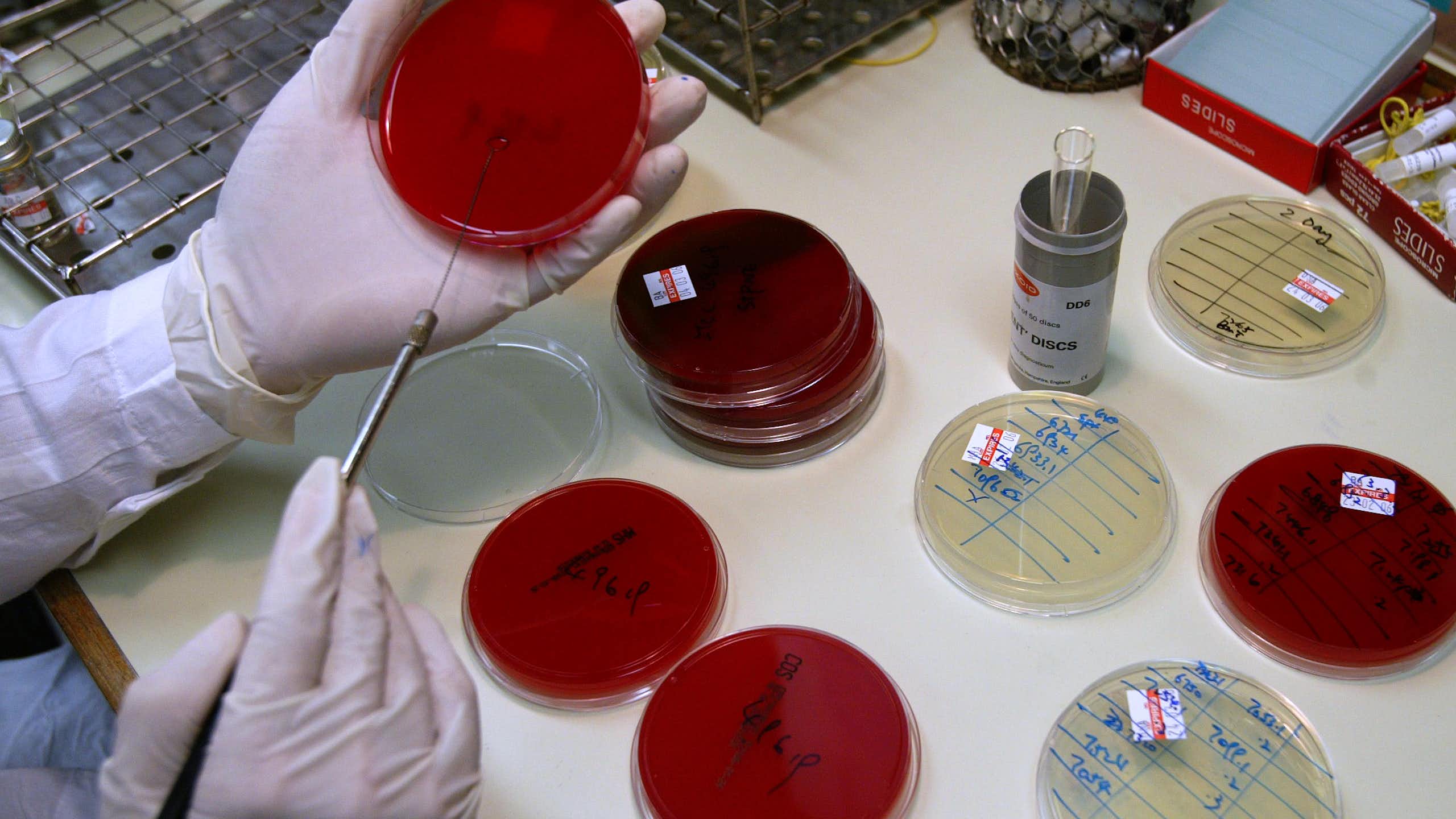 Gloved hands and round glass dishes in a laboratory environment