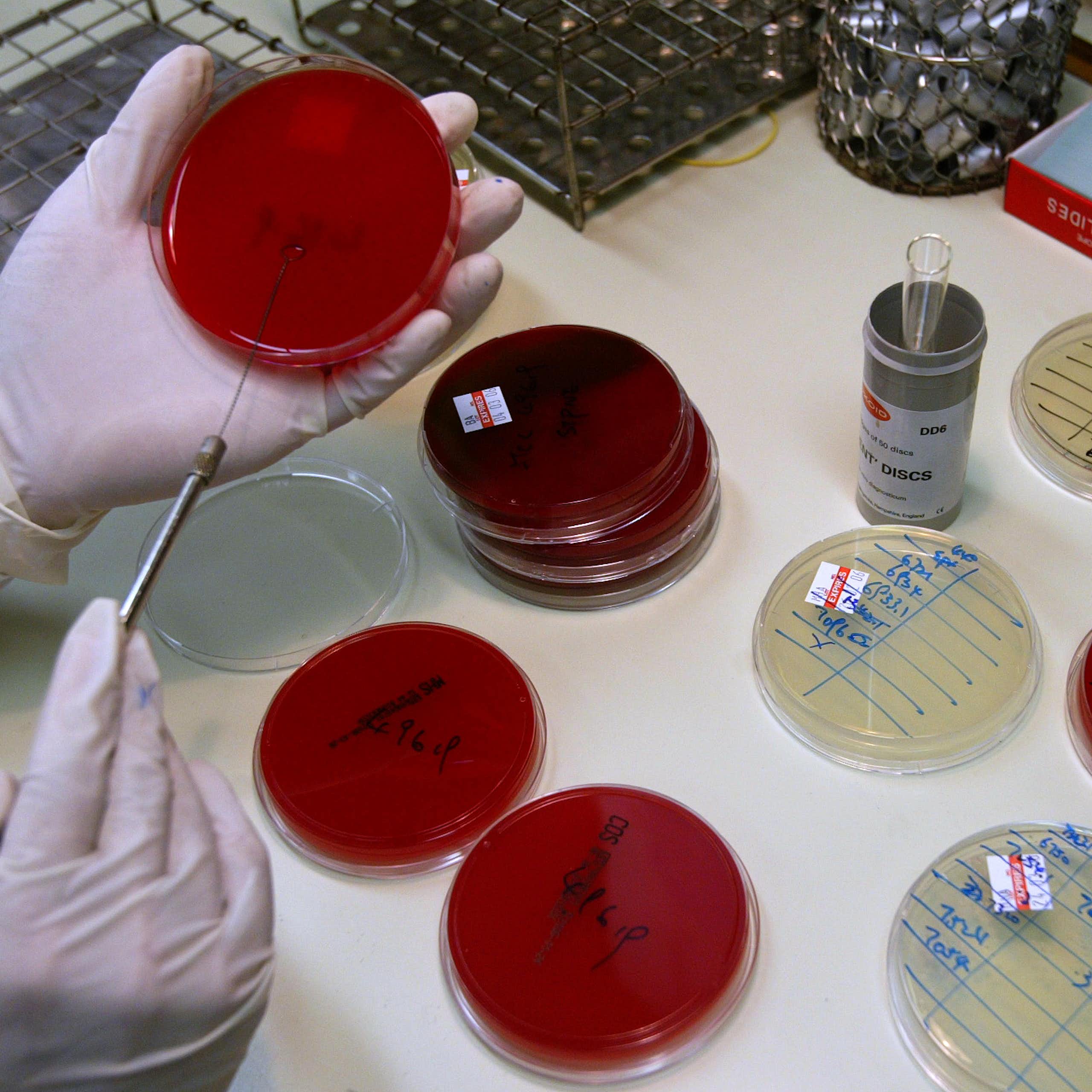 Gloved hands and round glass dishes in a laboratory environment