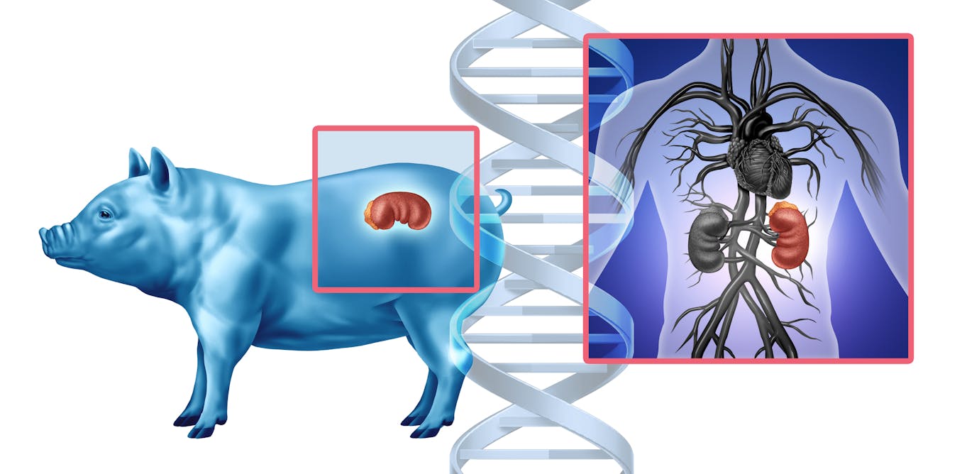 Putting pig organs in people is OK in the US, but growing human organs in pigs is not - why is that?