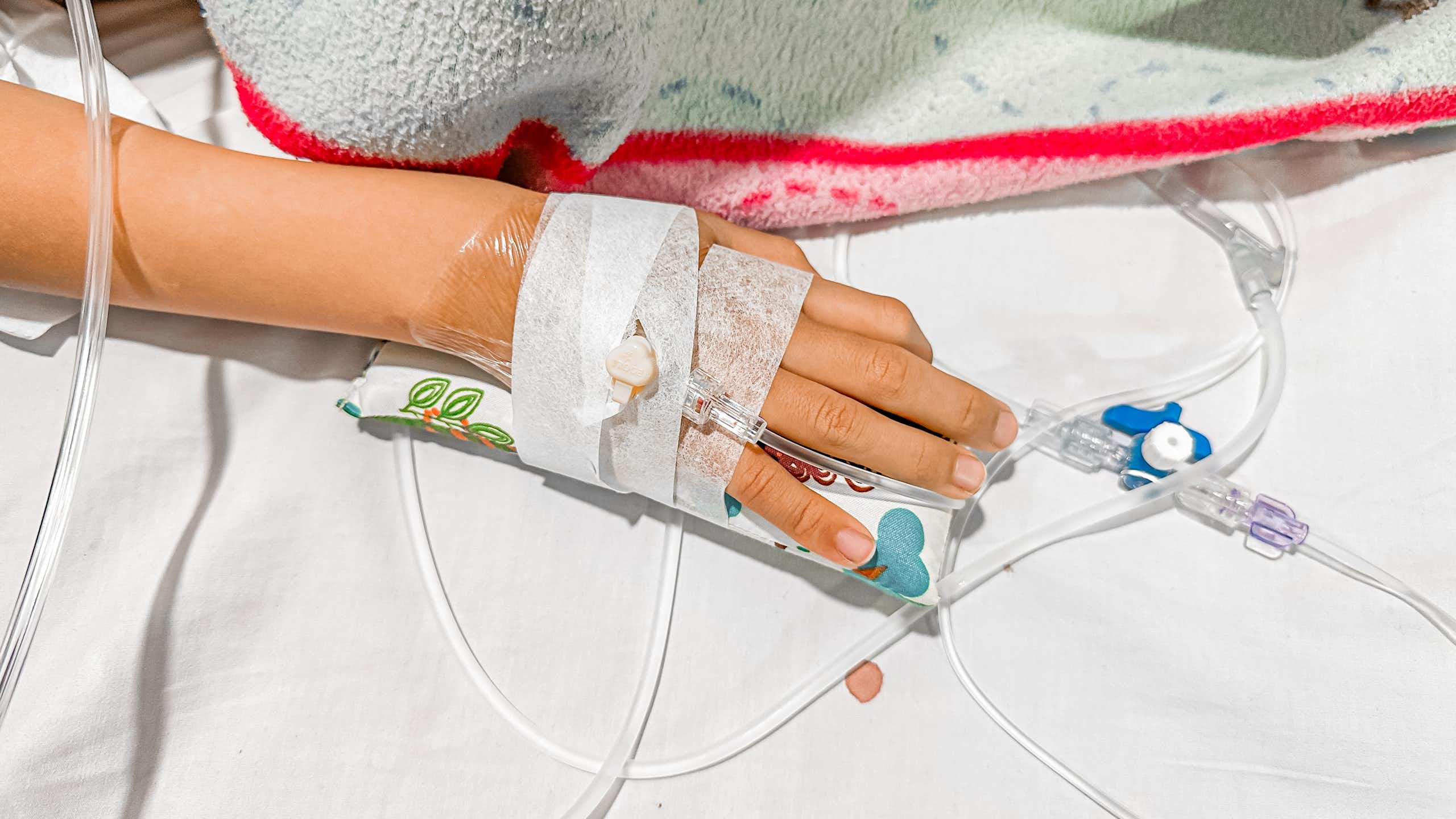 A child's hand with a cannula.
