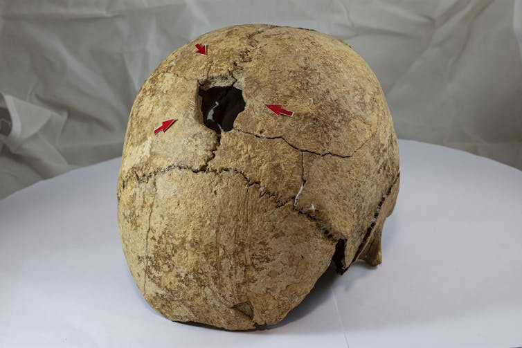 The reaction to ache in prehistory 1 file 20251210 56 k3n00j.jpg?ixlib=rb 4.1